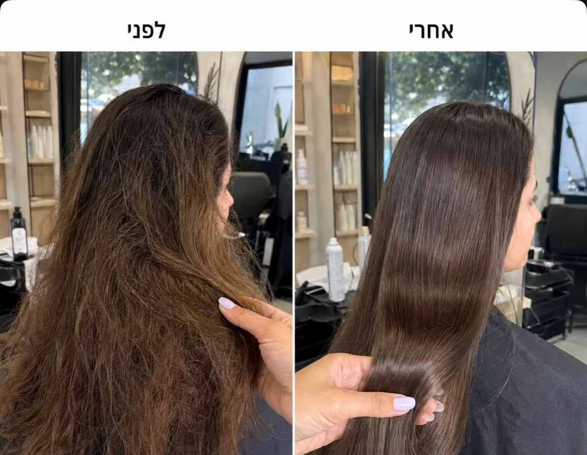 לפני ואחרי טיפול KOO KOO מון פלטין